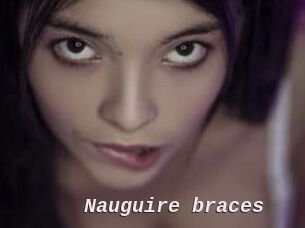 Nauguire_braces